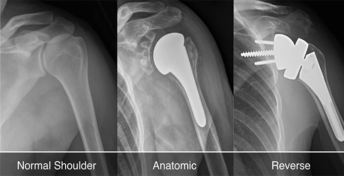 best Orthopedic Surgeon in Lucknow